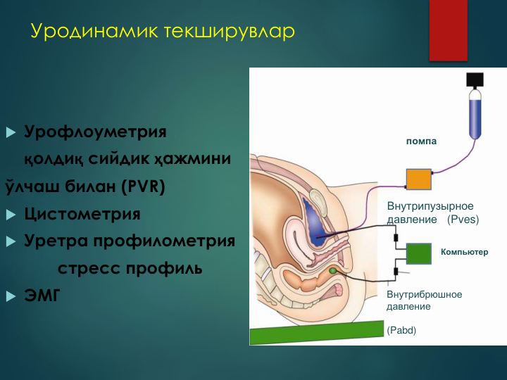Уродинамик текширувлар
 Урофлоуметрия 
қолдиқ сийдик ҳажмини  
ўлчаш билан (PVR)
 Цистометрия 
 Уретра профилометрия 
стресс профиль
 ЭМГ 
Внутрипузырное 
давление   (Pves)
Внутрибрюшное 
давление
(Pabd)
Компьютер
помпа
