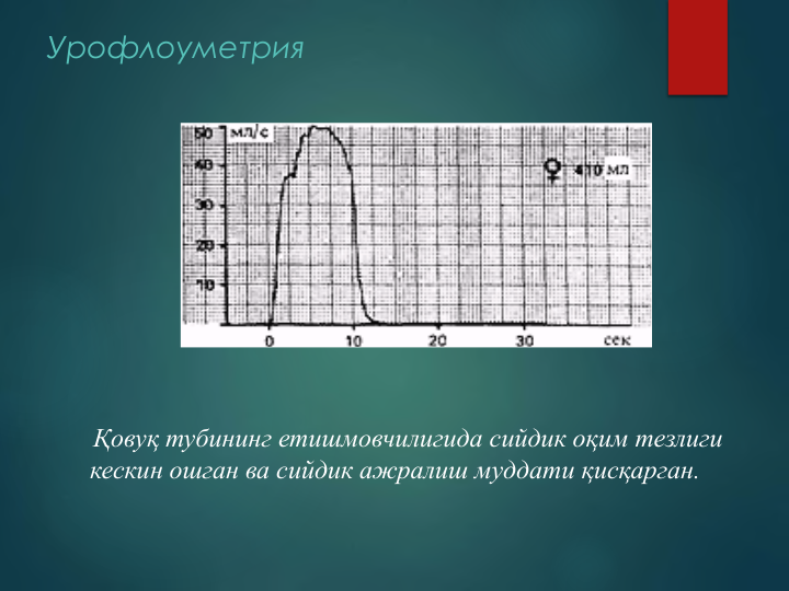 Қовуқ тубининг етишмовчилигида сийдик оқим тезлиги 
кескин ошган ва сийдик ажралиш муддати қисқарган.
Урофлоуметрия
