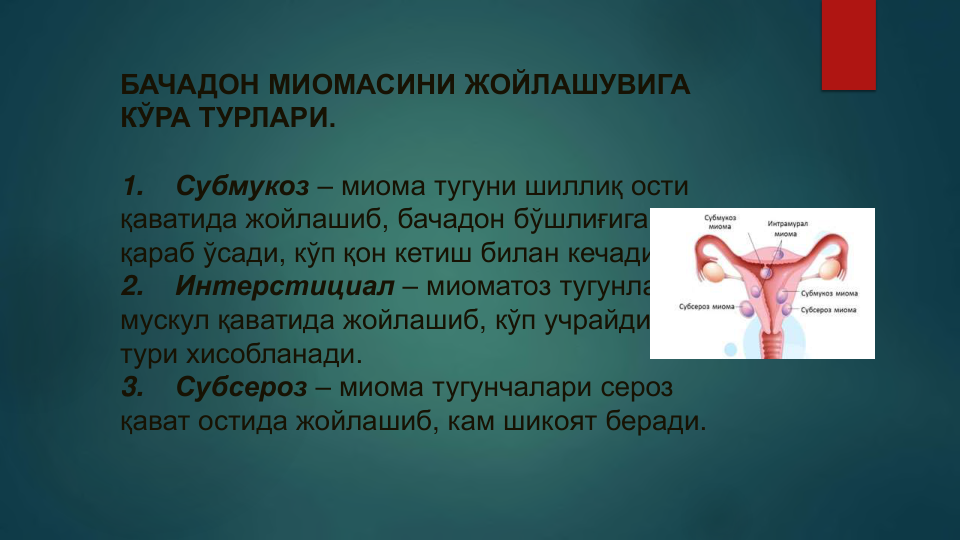 БАЧАДОН МИОМАСИНИ ЖОЙЛАШУВИГА 
КЎРА ТУРЛАРИ.
1.
Субмукоз – миома тугуни шиллиқ ости 
қаватида жойлашиб, бачадон бўшлиғига
қараб ўсади, кўп қон кетиш билан кечади.
2.
Интерстициал – миоматоз тугунлар
мускул қаватида жойлашиб, кўп учрайдиган
тури хисобланади.
3.
Субсероз – миома тугунчалари сероз
қават остида жойлашиб, кам шикоят беради.
