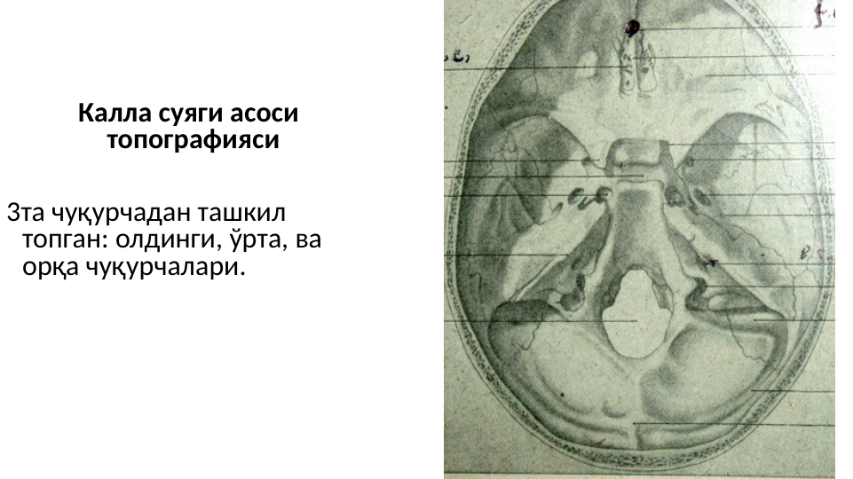  Калла суяги асоси 
топографияси
3та чуқурчадан ташкил 
топган: олдинги, ўрта, ва 
орқа чуқурчалари. 
