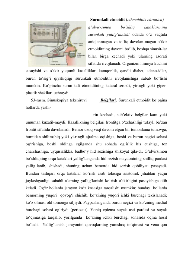   Surunkali etmoidit (ethmoiditis chronica) – 
g‘alvir-simon 
bo‘shliq 
kataklarining 
surunkali yallig‘lanishi odatda o‘z vaqtida 
aniqlanmagan va to‘liq davolan-magan o‘tkir 
etmoiditning davomi bo‘lib, boshqa sinusit-lar 
bilan birga kechadi yoki ularning asorati 
sifatida rivojlanadi. Organizm himoya kuchini 
susayishi va o‘tkir yuqumli kasalliklar, kamqonlik, qandli diabet, adeno-idlar, 
burun to‘sig‘i qiyshiqligi surunkali etmoiditni rivojlanishiga sabab bo‘lishi 
mumkin. Ko‘pincha surun-kali etmoiditning kataral-serozli, yiringli yoki giper-
plastik shakllari uchraydi. 
     53-rasm. Sinuskopiya tekshiruvi         Belgilari. Surunkali etmoidit ko‘pgina 
hollarda yashi-   
                                                                rin kechadi, sub’ektiv belgilar kam yoki 
umuman kuzatil-maydi. Kasallikning belgilari frontitga o‘xshashligi tufayli ba’zan 
frontit sifatida davolanadi. Bemor uzoq vaqt davom etgan bir tomonlama tumovga, 
burnidan shilimshiq yoki yi-ringli ajralma oqishiga, boshi va burun negizi sohasi 
og‘rishiga, boshi oldinga egilganda shu sohada og‘irlik his etishiga, tez 
charchashiga, uyqusizlikka, badbo‘y hid sezishiga shikoyat qila-di. G‘alvirsimon 
bo‘shliqning orqa kataklari yallig‘langanda hid sezish maydonining shilliq pardasi 
yallig‘lanib, shishadi, shuning uchun bemorda hid sezish qobiliyati pasayadi. 
Bundan tashqari orqa kataklar ko‘rish asab tolasiga anatomik jihatdan yaqin 
joylashganligi sababli ularning yallig‘lanishi ko‘rish o‘tkirligini pasayishiga olib 
keladi. Og‘ir hollarda jarayon ko‘z kosasiga tarqalishi mumkin; bunday  hollarda 
bemorning yuqori  qovog‘i shishib, ko‘zining yuqori ichki burchagi tekislanadi; 
ko‘z olmasi old tomonga siljiydi. Paypaslanganda burun negizi va ko‘zning medial 
burchagi sohasi og‘riydi (periostit). Yopiq epiema suyak usti pardasi va suyak 
to‘qimasiga tarqalib, yorilganda  ko‘zning ichki burchagi sohasida oqma hosil 
bo‘ladi.  Yallig‘lanish jarayonini qovoqlarning yumshoq to‘qimasi va vena qon 
