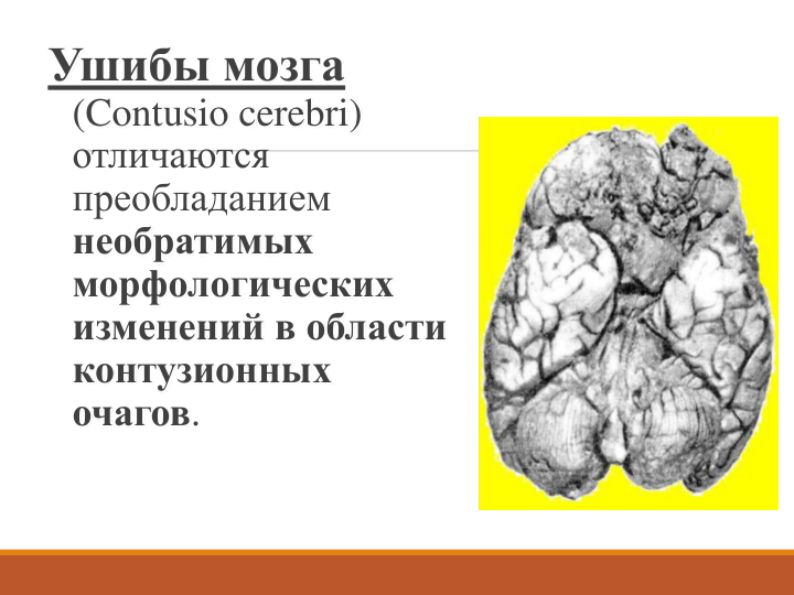 Ушибы мозга
(Contusio cerebri)
отличаются 
преобладанием 
необратимых 
морфологических 
изменений в области
контузионных
очагов. 
