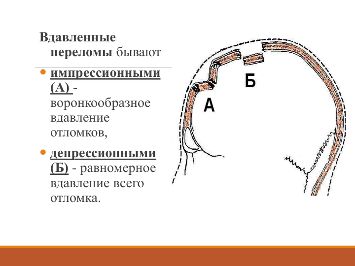 Вдавленные 
переломы бывают
 импрессионными
(А) -
воронкообразное 
вдавление 
отломков,
 депрессионными 
(Б) - равномерное 
вдавление всего 
отломка.
