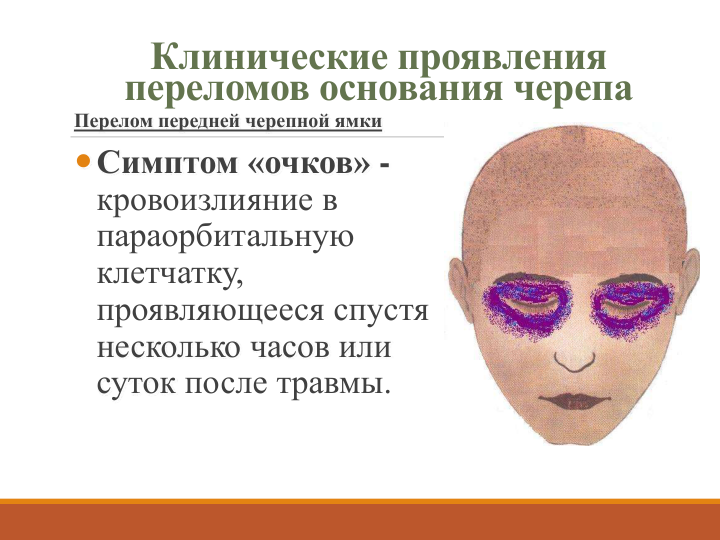 Клинические проявления 
переломов основания черепа
Перелом передней черепной ямки
Симптом «очков» -
кровоизлияние в 
параорбитальную
клетчатку, 
проявляющееся спустя 
несколько часов или 
суток после травмы.
