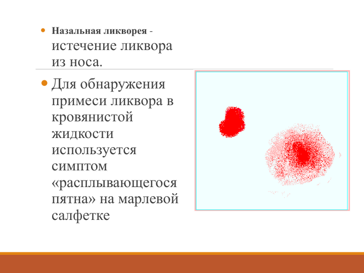  Назальная ликворея -
истечение ликвора 
из носа.
 Для обнаружения 
примеси ликвора в 
кровянистой 
жидкости 
используется 
симптом 
«расплывающегося 
пятна» на марлевой 
салфетке
