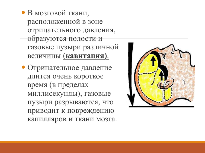  В мозговой ткани, 
расположенной в зоне 
отрицательного давления,
образуются полости и 
газовые пузыри различной 
величины (кавитация).
 Отрицательное давление 
длится очень короткое 
время (в пределах 
миллисекунды), газовые 
пузыри разрываются, что 
приводит к повреждению 
капилляров и ткани мозга. 

