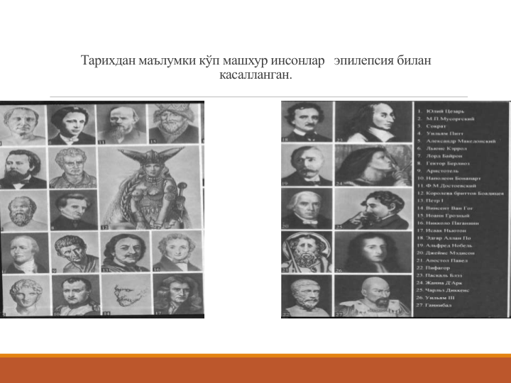 Тарихдан маълумки кўп машхур инсонлар эпилепсия билан 
касалланган. 
