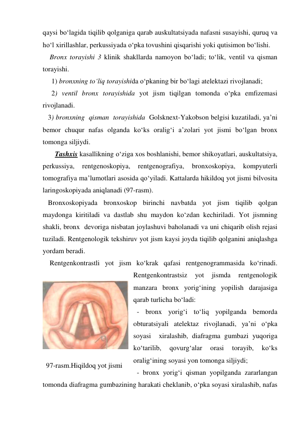 qaysi bo‘lagida tiqilib qolganiga qarab auskultatsiyada nafasni susayishi, quruq va 
ho‘l xirillashlar, perkussiyada o‘pka tovushini qisqarishi yoki qutisimon bo‘lishi. 
    Bronx torayishi 3 klinik shakllarda namoyon bo‘ladi; to‘lik, ventil va qisman 
torayishi.  
     1) bronxning to‘liq torayishida o‘pkaning bir bo‘lagi atelektazi rivojlanadi; 
     2) ventil bronx torayishida yot jism tiqilgan tomonda o‘pka emfizemasi 
rivojlanadi. 
   3) bronxning  qisman  torayishida  Golsknext-Yakobson belgisi kuzatiladi, ya’ni 
bemor chuqur nafas olganda ko‘ks oralig‘i a’zolari yot jismi bo‘lgan bronx 
tomonga siljiydi.    
       Tashxis kasallikning o‘ziga xos boshlanishi, bemor shikoyatlari, auskultatsiya, 
perkussiya, 
rentgenoskopiya, 
rentgenografiya, 
bronxoskopiya, 
kompyuterli 
tomografiya ma’lumotlari asosida qo‘yiladi. Kattalarda hikildoq yot jismi bilvosita 
laringoskopiyada aniqlanadi (97-rasm). 
   Bronxoskopiyada bronxoskop birinchi navbatda yot jism tiqilib qolgan 
maydonga kiritiladi va dastlab shu maydon ko‘zdan kechiriladi. Yot jismning 
shakli, bronx  devoriga nisbatan joylashuvi baholanadi va uni chiqarib olish rejasi 
tuziladi. Rentgenologik tekshiruv yot jism kaysi joyda tiqilib qolganini aniqlashga 
yordam beradi. 
    Rentgenkontrastli yot jism ko‘krak qafasi rentgenogrammasida ko‘rinadi. 
Rentgenkontrastsiz 
yot 
jismda 
rentgenologik 
manzara bronx yorig‘ining yopilish darajasiga 
qarab turlicha bo‘ladi: 
  - bronx yorig‘i to‘liq yopilganda bemorda 
obturatsiyali atelektaz rivojlanadi, ya’ni o‘pka 
soyasi  xiralashib, diafragma gumbazi yuqoriga 
ko‘tarilib, 
qovurg‘alar 
orasi 
torayib, 
ko‘ks 
oralig‘ining soyasi yon tomonga siljiydi;  
  - bronx yorig‘i qisman yopilganda zararlangan 
tomonda diafragma gumbazining harakati cheklanib, o‘pka soyasi xiralashib, nafas 
 
97-rasm.Hiqildoq yot jismi 
