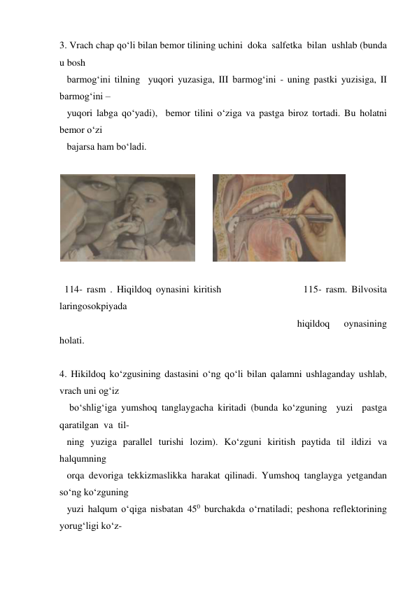 3. Vrach chap qo‘li bilan bemor tilining uchini  doka  salfetka  bilan  ushlab (bunda 
u bosh  
   barmog‘ini tilning  yuqori yuzasiga, III barmog‘ini - uning pastki yuzisiga, II 
barmog‘ini –  
   yuqori labga qo‘yadi),  bemor tilini o‘ziga va pastga biroz tortadi. Bu holatni 
bemor o‘zi  
   bajarsa ham bo‘ladi. 
 
       
  
 
  114- rasm . Hiqildoq oynasini kiritish                   115- rasm. Bilvosita 
laringosokpiyada  
                                                                                                 hiqildoq 
oynasining 
holati. 
 
4. Hikildoq ko‘zgusining dastasini o‘ng qo‘li bilan qalamni ushlaganday ushlab, 
vrach uni og‘iz  
    bo‘shlig‘iga yumshoq tanglaygacha kiritadi (bunda ko‘zguning  yuzi  pastga  
qaratilgan  va  til- 
   ning yuziga parallel turishi lozim). Ko‘zguni kiritish paytida til ildizi va 
halqumning  
   orqa devoriga tekkizmaslikka harakat qilinadi. Yumshoq tanglayga yetgandan 
so‘ng ko‘zguning  
   yuzi halqum o‘qiga nisbatan 450 burchakda o‘rnatiladi; peshona reflektorining 
yorug‘ligi ko‘z- 
