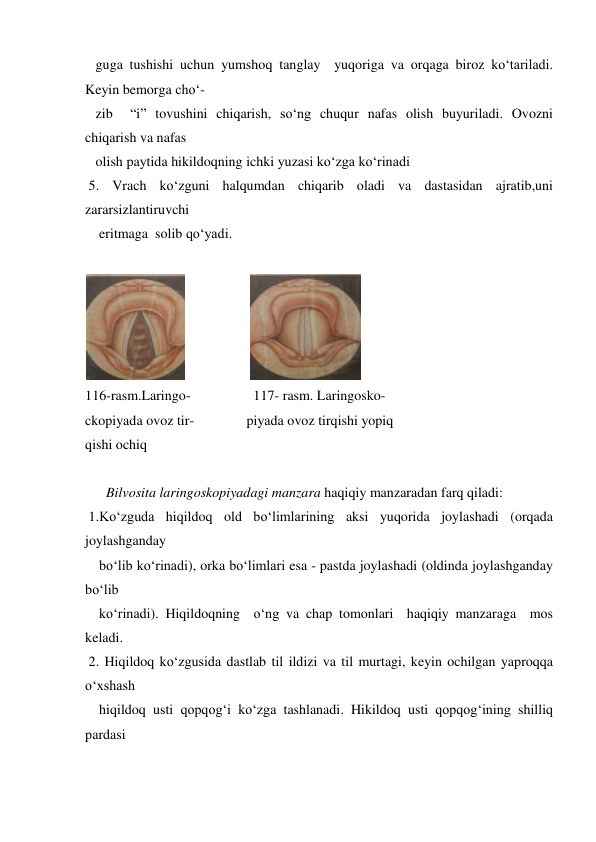    guga tushishi uchun yumshoq tanglay  yuqoriga va orqaga biroz ko‘tariladi. 
Keyin bemorga cho‘- 
   zib  “i” tovushini chiqarish, so‘ng chuqur nafas olish buyuriladi. Ovozni 
chiqarish va nafas  
   olish paytida hikildoqning ichki yuzasi ko‘zga ko‘rinadi  
 5. Vrach ko‘zguni halqumdan chiqarib oladi va dastasidan ajratib,uni 
zararsizlantiruvchi  
    eritmaga  solib qo‘yadi. 
 
                  
 
116-rasm.Laringo-                  117- rasm. Laringosko-  
ckopiyada ovoz tir-               piyada ovoz tirqishi yopiq  
qishi ochiq                              
       
      Bilvosita laringoskopiyadagi manzara haqiqiy manzaradan farq qiladi:  
 1.Ko‘zguda hiqildoq old bo‘limlarining aksi yuqorida joylashadi (orqada 
joylashganday  
    bo‘lib ko‘rinadi), orka bo‘limlari esa - pastda joylashadi (oldinda joylashganday 
bo‘lib    
    ko‘rinadi). Hiqildoqning  o‘ng va chap tomonlari  haqiqiy manzaraga  mos 
keladi.  
 2. Hiqildoq ko‘zgusida dastlab til ildizi va til murtagi, keyin ochilgan yaproqqa 
o‘xshash  
    hiqildoq usti qopqog‘i ko‘zga tashlanadi. Hikildoq usti qopqog‘ining shilliq 
pardasi  
