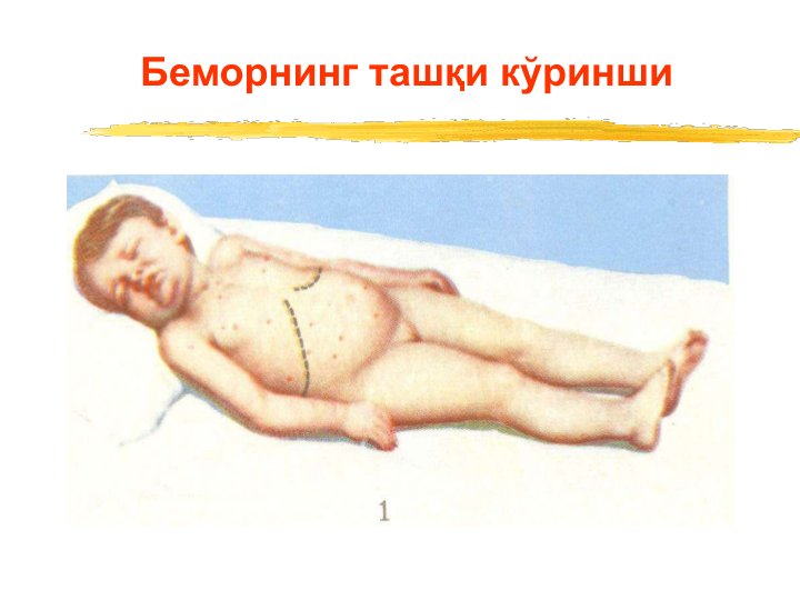 Беморнинг ташқи кўринши
