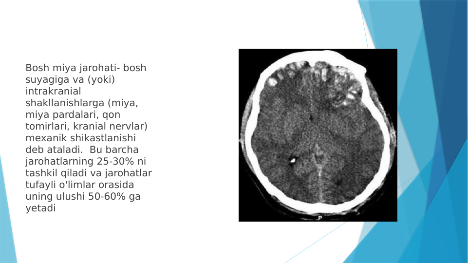 Bosh miya jarohati- bosh 
suyagiga va (yoki) 
intrakranial 
shakllanishlarga (miya, 
miya pardalari, qon 
tomirlari, kranial nervlar) 
mexanik shikastlanishi 
deb ataladi.  Bu barcha 
jarohatlarning 25-30% ni 
tashkil qiladi va jarohatlar 
tufayli o'limlar orasida 
uning ulushi 50-60% ga 
yetadi
