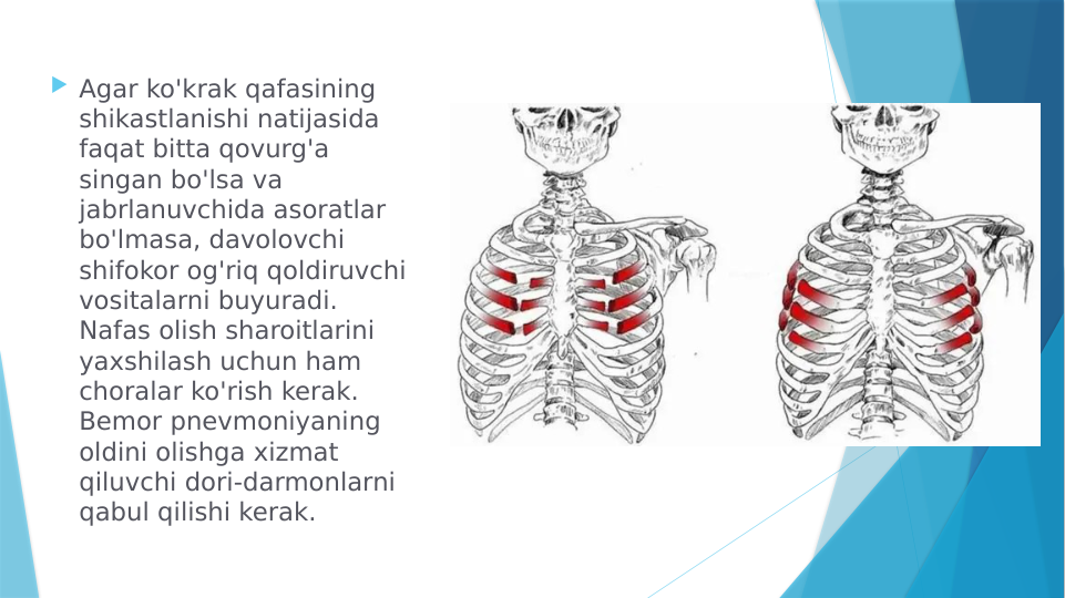  Agar ko'krak qafasining 
shikastlanishi natijasida 
faqat bitta qovurg'a 
singan bo'lsa va 
jabrlanuvchida asoratlar 
bo'lmasa, davolovchi 
shifokor og'riq qoldiruvchi 
vositalarni buyuradi. 
Nafas olish sharoitlarini 
yaxshilash uchun ham 
choralar ko'rish kerak. 
Bemor pnevmoniyaning 
oldini olishga xizmat 
qiluvchi dori-darmonlarni 
qabul qilishi kerak.
