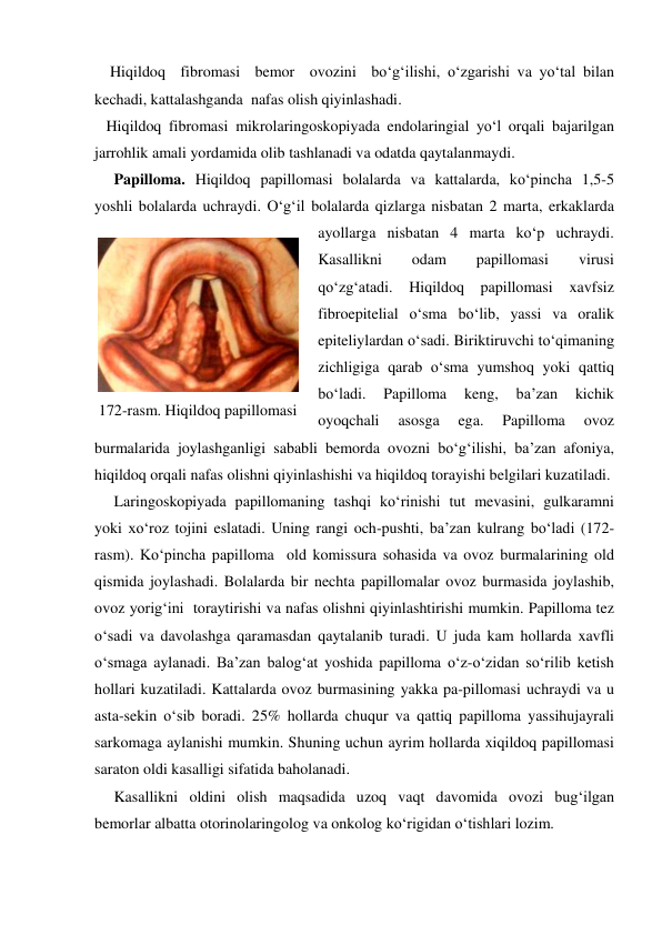     Hiqildoq  fibromasi  bemor  ovozini  bo‘g‘ilishi, o‘zgarishi va yo‘tal bilan 
kechadi, kattalashganda  nafas olish qiyinlashadi.  
   Hiqildoq fibromasi mikrolaringoskopiyada endolaringial yo‘l orqali bajarilgan 
jarrohlik amali yordamida olib tashlanadi va odatda qaytalanmaydi. 
     Papilloma. Hiqildoq papillomasi bolalarda va kattalarda, ko‘pincha 1,5-5 
yoshli bolalarda uchraydi. O‘g‘il bolalarda qizlarga nisbatan 2 marta, erkaklarda 
ayollarga nisbatan 4 marta ko‘p uchraydi. 
Kasallikni 
odam 
papillomasi 
virusi 
qo‘zg‘atadi. Hiqildoq papillomasi xavfsiz 
fibroepitelial o‘sma bo‘lib, yassi va oralik 
epiteliylardan o‘sadi. Biriktiruvchi to‘qimaning 
zichligiga qarab o‘sma yumshoq yoki qattiq 
bo‘ladi. 
Papilloma 
keng, 
ba’zan 
kichik 
oyoqchali 
asosga 
ega. 
Papilloma 
ovoz 
burmalarida joylashganligi sababli bemorda ovozni bo‘g‘ilishi, ba’zan afoniya, 
hiqildoq orqali nafas olishni qiyinlashishi va hiqildoq torayishi belgilari kuzatiladi. 
     Laringoskopiyada papillomaning tashqi ko‘rinishi tut mevasini, gulkaramni 
yoki xo‘roz tojini eslatadi. Uning rangi och-pushti, ba’zan kulrang bo‘ladi (172-
rasm). Ko‘pincha papilloma  old komissura sohasida va ovoz burmalarining old  
qismida joylashadi. Bolalarda bir nechta papillomalar ovoz burmasida joylashib, 
ovoz yorig‘ini  toraytirishi va nafas olishni qiyinlashtirishi mumkin. Papilloma tez 
o‘sadi va davolashga qaramasdan qaytalanib turadi. U juda kam hollarda xavfli 
o‘smaga aylanadi. Ba’zan balog‘at yoshida papilloma o‘z-o‘zidan so‘rilib ketish 
hollari kuzatiladi. Kattalarda ovoz burmasining yakka pa-pillomasi uchraydi va u 
asta-sekin o‘sib boradi. 25% hollarda chuqur va qattiq papilloma yassihujayrali 
sarkomaga aylanishi mumkin. Shuning uchun ayrim hollarda xiqildoq papillomasi 
saraton oldi kasalligi sifatida baholanadi. 
     Kasallikni oldini olish maqsadida uzoq vaqt davomida ovozi bug‘ilgan 
bemorlar albatta otorinolaringolog va onkolog ko‘rigidan o‘tishlari lozim. 
 
172-rasm. Hiqildoq papillomasi 
