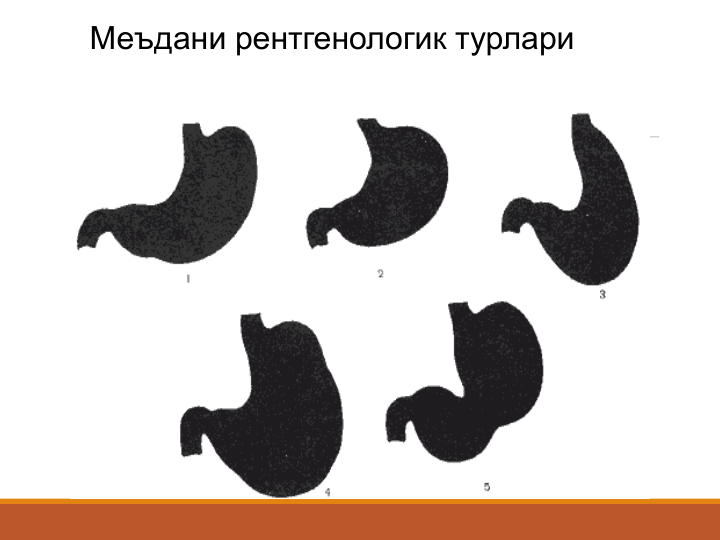 Меъдани рентгенологик турлари
