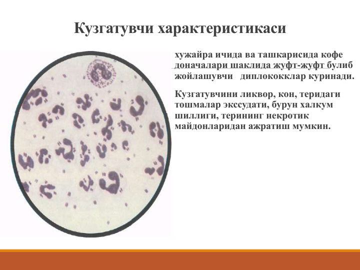 Кузгатувчи характеристикаси
хужайра ичида ва ташкарисида кофе 
доначалари шаклида жуфт-жуфт булиб 
жойлашувчи диплококклар куринади. 
Кузгатувчини ликвор, кон, теридаги 
тошмалар экссудати, бурун халкум 
шиллиги, терининг некротик 
майдонларидан ажратиш мумкин.
