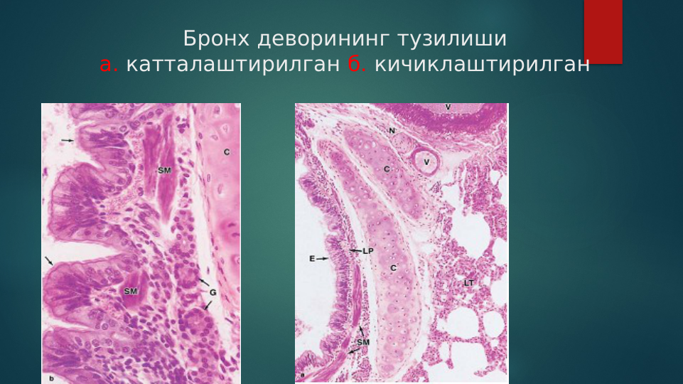 Бронх деворининг тузилиши
а. катталаштирилган б. кичиклаштирилган
                                          
