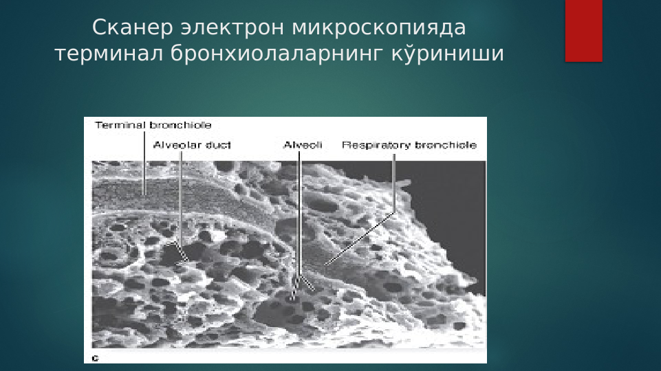 Сканер электрон микроскопияда 
терминал бронхиолаларнинг кўриниши 

