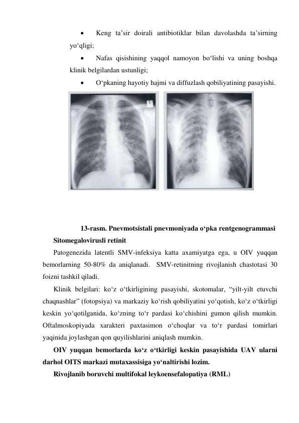  
Keng ta’sir doirali antibiotiklar bilan davolashda ta’sirning 
yo‘qligi; 
 
Nafas qisishining yaqqol namoyon bo‘lishi va uning boshqa 
klinik belgilardan ustunligi; 
 
O‘pkaning hayotiy hajmi va diffuzlash qobiliyatining pasayishi. 
 
 
 
 
 
 
 
 
 
 
 
13-rasm. Pnevmotsistali pnevmoniyada o‘pka rentgenogrammasi 
Sitomegalovirusli retinit 
Patogenezida latentli SMV-infeksiya katta axamiyatga ega, u OIV yuqqan 
bemorlarning 50-80% da aniqlanadi.  SMV-retinitning rivojlanish chastotasi 30 
foizni tashkil qiladi. 
Klinik belgilari: ko‘z o‘tkirligining pasayishi, skotomalar, “yilt-yilt etuvchi 
chaqnashlar” (fotopsiya) va markaziy ko‘rish qobiliyatini yo‘qotish, ko‘z o‘tkirligi 
keskin yo‘qotilganida, ko‘zning to‘r pardasi ko‘chishini gumon qilish mumkin. 
Oftalmoskopiyada xarakteri paxtasimon o‘choqlar va to‘r pardasi tomirlari 
yaqinida joylashgan qon quyilishlarini aniqlash mumkin. 
OIV yuqqan bemorlarda ko‘z o‘tkirligi keskin pasayishida UAV ularni 
darhol OITS markazi mutaxassisiga yo‘naltirishi lozim.  
Rivojlanib boruvchi multifokal leykoensefalopatiya (RML) 
