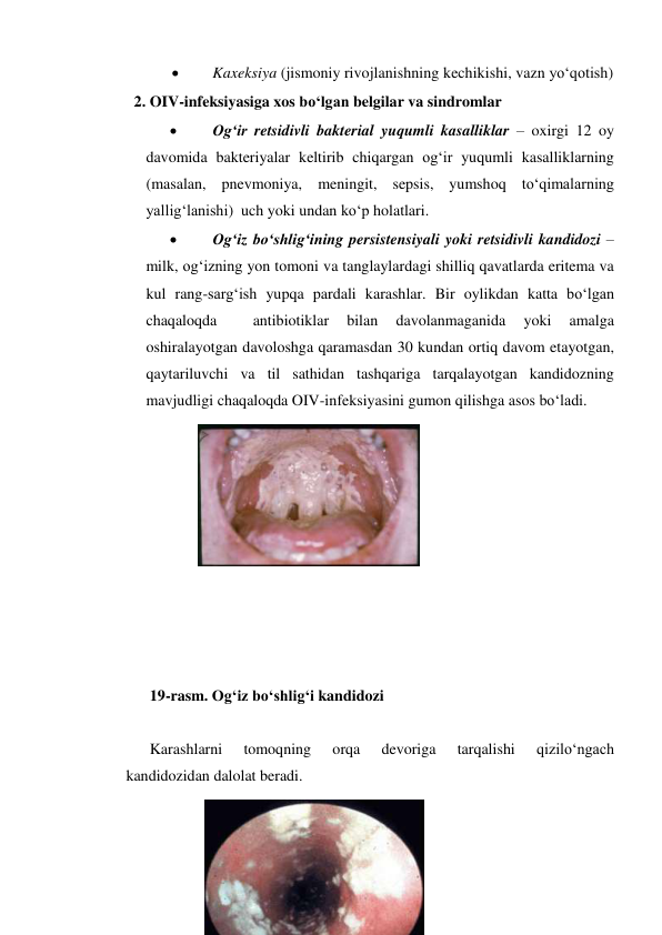  
Kaxeksiya (jismoniy rivojlanishning kechikishi, vazn yo‘qotish) 
2. OIV-infeksiyasiga xos bo‘lgan belgilar va sindromlar 
 
Og‘ir retsidivli bakterial yuqumli kasalliklar – oxirgi 12 oy 
davomida bakteriyalar keltirib chiqargan og‘ir yuqumli kasalliklarning 
(masalan, pnevmoniya, meningit, sepsis, yumshoq to‘qimalarning 
yallig‘lanishi)  uch yoki undan ko‘p holatlari. 
 
Og‘iz bo‘shlig‘ining persistensiyali yoki retsidivli kandidozi – 
milk, og‘izning yon tomoni va tanglaylardagi shilliq qavatlarda eritema va 
kul rang-sarg‘ish yupqa pardali karashlar. Bir oylikdan katta bo‘lgan 
chaqaloqda 
 
antibiotiklar 
bilan 
davolanmaganida 
yoki 
amalga 
oshiralayotgan davoloshga qaramasdan 30 kundan ortiq davom etayotgan, 
qaytariluvchi va til sathidan tashqariga tarqalayotgan kandidozning 
mavjudligi chaqaloqda OIV-infeksiyasini gumon qilishga asos bo‘ladi. 
 
 
 
 
 
 
 
 
 
 
19-rasm. Og‘iz bo‘shlig‘i kandidozi 
 
Karashlarni 
tomoqning 
orqa 
devoriga 
tarqalishi 
qizilo‘ngach 
kandidozidan dalolat beradi. 
 
 
 
