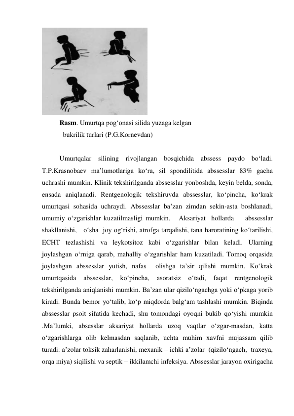  
Rasm. Umurtqa pog‘onasi silida yuzaga kelgan  
  bukrilik turlari (P.G.Kornevdan) 
 
Umurtqalar silining rivojlangan bosqichida abssess paydo bo‘ladi. 
T.P.Krasnobaev ma’lumotlariga ko‘ra, sil spondilitida abssesslar 83% gacha 
uchrashi mumkin. Klinik tekshirilganda abssesslar yonboshda, keyin belda, sonda, 
ensada aniqlanadi. Rentgenologik tekshiruvda abssesslar, ko‘pincha, ko‘krak 
umurtqasi sohasida uchraydi. Abssesslar ba’zan zimdan sekin-asta boshlanadi, 
umumiy o‘zgarishlar kuzatilmasligi mumkin.   Aksariyat  hollarda    abssesslar    
shakllanishi,   o‘sha  joy og‘rishi, atrofga tarqalishi, tana haroratining ko‘tarilishi, 
ECHT tezlashishi va leykotsitoz kabi o‘zgarishlar bilan keladi. Ularning 
joylashgan o‘rniga qarab, mahalliy o‘zgarishlar ham kuzatiladi. Tomoq orqasida 
joylashgan abssesslar yutish, nafas  olishga ta’sir qilishi mumkin. Ko‘krak 
umurtqasida 
abssesslar, 
ko‘pincha, 
asoratsiz 
o‘tadi, 
faqat 
rentgenologik 
tekshirilganda aniqlanishi mumkin. Ba’zan ular qizilo‘ngachga yoki o‘pkaga yorib 
kiradi. Bunda bemor yo‘talib, ko‘p miqdorda balg‘am tashlashi mumkin. Biqinda 
abssesslar psoit sifatida kechadi, shu tomondagi oyoqni bukib qo‘yishi mumkin 
.Ma’lumki, absesslar aksariyat hollarda uzoq vaqtlar o‘zgar-masdan, katta 
o‘zgarishlarga olib kelmasdan saqlanib, uchta muhim xavfni mujassam qilib  
turadi: a’zolar toksik zaharlanishi, mexanik – ichki a’zolar  (qizilo‘ngach,  traxeya,  
orqa miya) siqilishi va septik – ikkilamchi infeksiya. Abssesslar jarayon oxirigacha 
