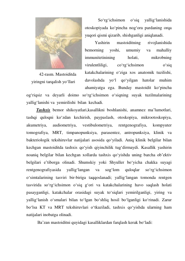     So‘rg‘ichsimon 
o‘siq 
yallig‘lanishida 
otoskopiyada ko‘pincha nog‘ora pardaning orqa 
yuqori qismi qizarib, shishganligi aniqlanadi.  
 Yashirin 
mastoiditning 
rivojlanishida 
bemorning 
yoshi, 
umumiy 
va 
mahalliy 
immunitetinining 
holati, 
mikrobning 
virulentliligi, 
co‘rg‘ichsimon 
 
o‘siq 
katakchalarining o‘ziga xos anatomik tuzilishi, 
davolashda 
yo‘l 
qo‘yilgan 
hatolar 
muhim 
ahamiyatga ega. Bunday mastoidit ko‘pincha 
og‘riqsiz va deyarli doimo so‘rg‘ichsimon o‘siqning suyak tuzilmalarining 
yallig‘lanishi va  yemirilishi  bilan  kechadi.  
 Tashxis bemor shikoyatlari,kasallikni boshlanishi, anamnez ma’lumotlari, 
tashqi quloqni ko‘zdan kechirish, paypaslash, otoskopiya, mikrootoskopiya, 
akumetriya, 
audiometriya, 
vestibulometriya, 
rentgenografiya, 
kompyuter 
tomografiya, MRT, timpanopunksiya, parasentez, antropunksiya, klinik va 
bakteriologik tekshiruvlar natijalari asosida qo‘yiladi. Aniq klinik belgilar bilan 
kechgan mastoiditda tashxis qo‘yish qiyinchilik tug‘dirmaydi. Kasallik yashirin 
noaniq belgilar bilan kechgan xollarda tashxis qo‘yishda uning barcha ob’ektiv 
belgilari e’tiborga olinadi. Shumskiy yoki Shyuller bo‘yicha chakka suyagi 
rentgenografiyasida 
yallig‘langan 
va 
sog‘lom 
quloqlar 
so‘rg‘ichsimon 
o‘simtalarining tasviri bir-biriga taqqoslanadi; yallig‘langan tomonda rentgen 
tasvirida so‘rg‘ichsimon o‘siq g‘ori va katakchalarining havo saqlash holati 
pasayganligi, katakchalar orasidagi suyak to‘siqlari yemirilganligi, yiring va 
yallig‘lanish o‘smalari bilan to‘lgan bo‘shliq hosil bo‘lganligi ko‘rinadi. Zarur 
bo‘lsa KT va MRT tekshiruvlari o‘tkaziladi, tashxis qo‘yishda ularning ham 
natijalari inobatga olinadi. 
  Ba’zan mastoiditni quyidagi kasalliklardan farqlash kerak bo‘ladi: 
 
42-rasm. Mastoiditda 
yiringni tarqalish yo‘llari 
