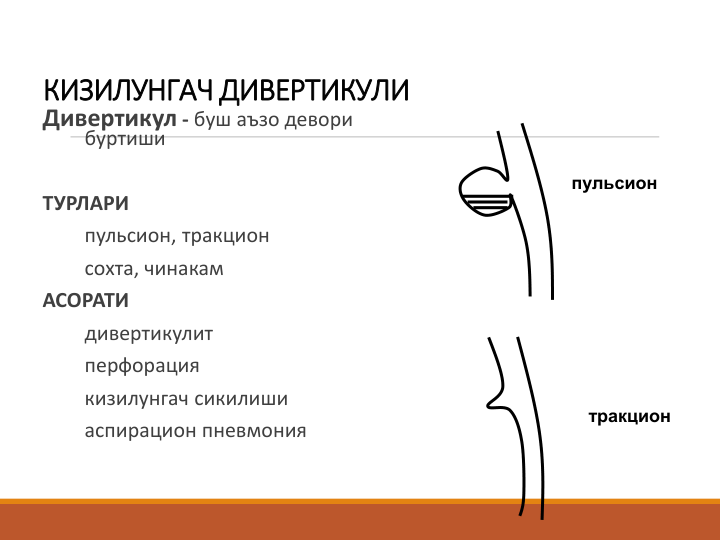 КИЗИЛУНГАЧ ДИВЕРТИКУЛИ
Дивертикул - буш аъзо девори 
буртиши 
ТУРЛАРИ 
пульсион, тракцион 
сохта, чинакам
АСОРАТИ
дивертикулит 
перфорация
кизилунгач сикилиши
аспирацион пневмония
пульсион
тракцион
