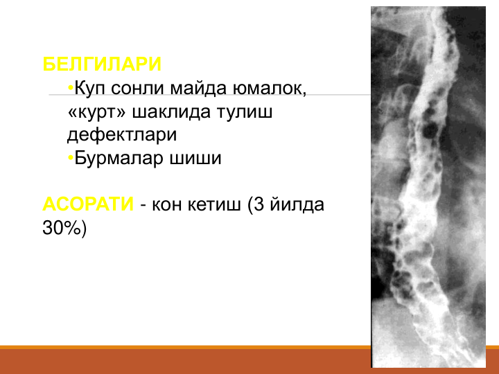 БЕЛГИЛАРИ
•Куп сонли майда юмалок, 
«курт» шаклида тулиш 
дефектлари
•Бурмалар шиши
АСОРАТИ - кон кетиш (3 йилда 
30%)
