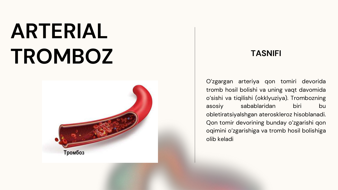 ARTERIAL 
TROMBOZ
TASNIFI
O’zgargan
arteriya
qon
tomiri
devorida
tromb hosil bolishi va uning vaqt davomida
o’sishi va tiqilishi (okklyuziya). Trombozning
asosiy
sabablaridan
biri
bu
obletiratsiyalshgan ateroskleroz hisoblanadi.
Qon tomir devorining bunday o’zgarishi qon
oqimini o’zgarishiga va tromb hosil bolishiga
olib keladi

