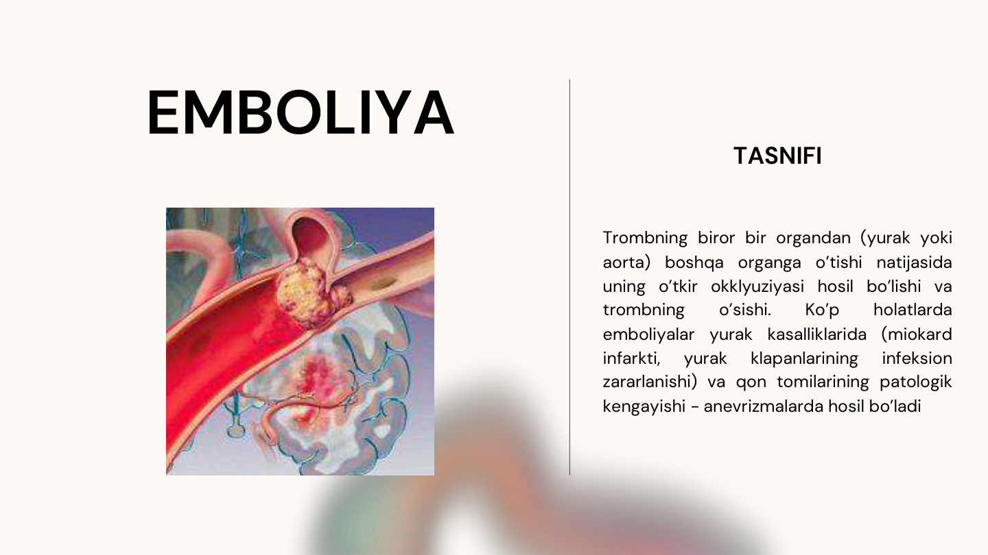 EMBOLIYA
TASNIFI
Trombning biror bir organdan (yurak yoki
aorta)
boshqa
organga
o’tishi
natijasida
uning o’tkir okklyuziyasi hosil bo’lishi va
trombning
o’sishi.
Ko’p
holatlarda
emboliyalar
yurak
kasalliklarida
(miokard
infarkti,
yurak
klapanlarining
infeksion
zararlanishi) va qon tomilarining patologik
kengayishi - anevrizmalarda hosil bo’ladi
