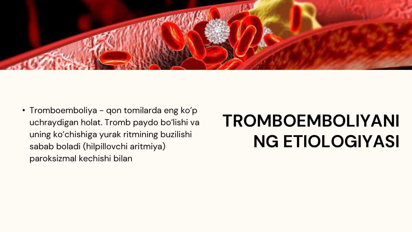 TROMBOEMBOLIYANI
NG ETIOLOGIYASI
• Tromboemboliya - qon tomilarda eng ko’p 
uchraydigan holat. Tromb paydo bo’lishi va 
uning ko’chishiga yurak ritmining buzilishi 
sabab boladi (hilpillovchi aritmiya) 
paroksizmal kechishi bilan
