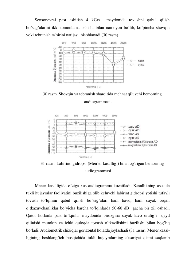 Sensonevral past eshitish 4 kGts  maydonida tovushni qabul qilish 
bo’sag’alarini ikki tomonlama oshishi bilan namoyon bo’lib, ko’pincha shovqin 
yoki tebranish ta`sirini natijasi  hisoblanadi (30 rasm). 
 
30 rasm. Shovqin va tebranish sharoitida mehnat qiluvchi bemorning 
audiogrammasi. 
 
 
31 rasm. Labirint  gidropsi (Men’er kasalligi) bilan og’rigan bemorning 
audiogrammasi 
 
Mener kasalligida o’ziga xos audiogramma kuzatiladi. Kasallikning asosida 
tukli hujayralar faoliyatini buzilishiga olib keluvchi labirint gidropsi yotishi tufayli 
tovush to’lqinini qabul qilish bo’sag’alari ham havo, ham suyak orqali 
o’tkazuvchanliklar bo’yicha barcha to’lqinlarda 50-60 dB  gacha bir xil oshadi. 
Qator hollarda past to’lqinlar maydonida birozgina suyak-havo oralig’i  qayd 
qilinishi mumkin va ichki quloqda tovush o’tkazilishini buzilishi bilan bog’liq 
bo’ladi. Audiometrik chiziqlar gorizontal holatda joylashadi (31 rasm). Mener kasal-
ligining boshlang’ich bosqichida tukli hujayralarning aksariyat qismi saqlanib 
