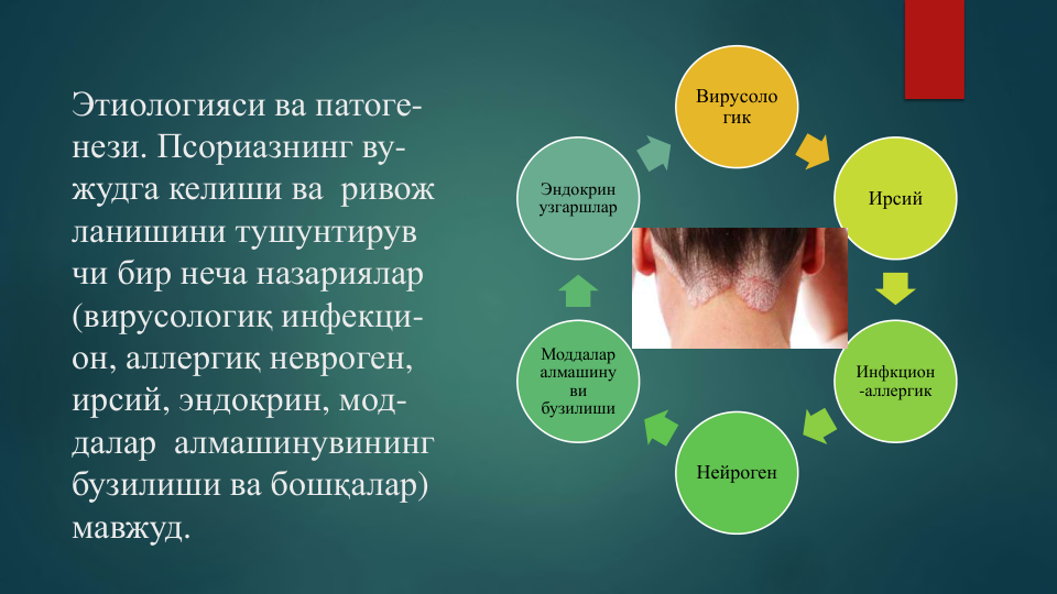Этиологияси ва патоге-
нези. Псориазнинг ву-
жудга келиши ва ривож
ланишини тушунтирув
чи бир неча назариялар
(вирусологиқ инфекци-
он, аллергиқ невроген, 
ирсий, эндокрин, мод-
далар алмашинувининг
бузилиши ва бошқалар) 
мавжуд.
Вирусоло
гик
Ирсий
Инфкцион
-аллергик
Нейроген
Моддалар
алмашину
ви
бузилиши
Эндокрин
узгаршлар
