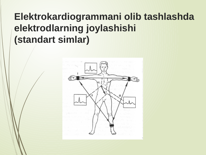 Elektrokardiogrammani olib tashlashda 
elektrodlarning joylashishi 
(standart simlar)
