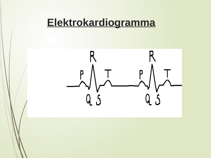 Elektrokardiogramma
