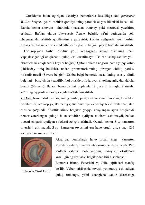       Otoskleroz bilan og‘rigan aksariyat bemorlarda kasallikga xos paracusis 
Willisii belgisi,  ya’ni eshitish qobiliyatining parodoksal yaxshilanishi kuzatiladi. 
Bunda bemor shovqin  sharoitda (masalan tramvay yoki metroda) yaxshiroq 
eshitadi. Ba’zan ularda deprecusis Scheer belgisi, ya’ni yutinganda yoki 
chaynaganda eshitish qobiliyatining pasayishi, keskin egilganda yoki boshini 
orqaga tashlaganda qisqa muddatli bosh aylanish belgisi  paydo bo‘lishi kuzatiladi.  
    Otoskopiyada tashqi eshituv yo‘li kengaygan, suyak qismining terisi 
yupqalashganligi aniqlanadi, quloq kiri kuzatilmaydi. Ba’zan tashqi eshituv yo‘li 
ekzostozlari aniqlanadi (Toynbi belgisi). Qator hollarda nog‘ora parda yupqalashib 
(shishaday tiniq bo‘lishi), undan promantoriumning qizargan shilliq pardasi 
ko‘rinib turadi (Shvars belgisi). Ushbu belgi bemorda kasallikning asosiy klinik 
belgilari   bosqichida kuzatilib, faol otosklerotik jarayon rivojlanganligidan dalolat 
beradi (53-rasm). Ba’zan bemorda teri qoplamlarini qurishi, tirnoqlarni sinishi, 
ko‘zning oq pardasi moviy rangda bo‘lishi kuzatiladi. 
Tashxis bemor shikoyatlari, uning yoshi, jinsi, anamnez ma’lumotlari, kasallikni 
boshlanishi, otoskopiya, akumetriya, audiometriya va boshqa tekshiruvlar natijalari 
asosida qo‘yiladi. Kasallik klinik belgilari yaqqol rivojlangan ayon bosqichida 
bemor zararlangan qulog‘i bilan shivirlab aytilgan so‘zlarni eshitmaydi, ba’zan 
ovozni chiqarib aytilgan so‘zlarni zo‘rg‘a eshitadi. Odatda bemor S 64  kamerton 
tovushini eshitmaydi, S 128  kamerton tovushini esa havo orqali qisqa vaqt (2-3 
soniya) davomida eshitadi. 
Aksariyat bemorlarda havo orqali S2048 
 kamerton 
tovushini eshitish muddati 4-5 martagacha qisqaradi. Past 
tonlarni eshitish qobiliyatining pasayishi otoskleroz 
kasalligining dastlabki belgilaridan biri hisoblanadi. 
Bemorda Rinne, Federichi va Jelle tajribalari manfiy 
bo‘lib, Veber tajribasida tovush yomonroq eshitadigan 
quloq tomonga, ya’ni uzangicha dahliz darchasiga 
 
53-rasm.Otoskleroz 
