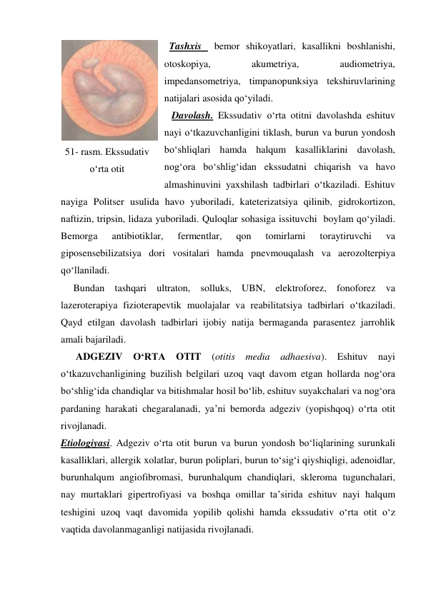   Tashxis  bemor shikoyatlari, kasallikni boshlanishi, 
otoskopiya, 
akumetriya, 
audiometriya, 
impedansometriya, timpanopunksiya tekshiruvlarining 
natijalari asosida qo‘yiladi. 
   Davolash. Ekssudativ o‘rta otitni davolashda eshituv 
nayi o‘tkazuvchanligini tiklash, burun va burun yondosh 
bo‘shliqlari hamda halqum kasalliklarini davolash, 
nog‘ora bo‘shlig‘idan ekssudatni chiqarish va havo 
almashinuvini yaxshilash tadbirlari o‘tkaziladi. Eshituv 
nayiga Politser usulida havo yuboriladi, kateterizatsiya qilinib, gidrokortizon, 
naftizin, tripsin, lidaza yuboriladi. Quloqlar sohasiga issituvchi  boylam qo‘yiladi. 
Bemorga 
antibiotiklar, 
fermentlar, 
qon 
tomirlarni 
toraytiruvchi 
va 
giposensebilizatsiya dori vositalari hamda pnevmouqalash va aerozolterpiya 
qo‘llaniladi.  
     Bundan tashqari ultraton, solluks, UBN, elektroforez, fonoforez va 
lazeroterapiya fizioterapevtik muolajalar va reabilitatsiya tadbirlari o‘tkaziladi. 
Qayd etilgan davolash tadbirlari ijobiy natija bermaganda parasentez jarrohlik 
amali bajariladi. 
      ADGEZIV 
O‘RTA 
OTIT 
(otitis media adhaesiva). Eshituv nayi 
o‘tkazuvchanligining buzilish belgilari uzoq vaqt davom etgan hollarda nog‘ora 
bo‘shlig‘ida chandiqlar va bitishmalar hosil bo‘lib, eshituv suyakchalari va nog‘ora 
pardaning harakati chegaralanadi, ya’ni bemorda adgeziv (yopishqoq) o‘rta otit 
rivojlanadi. 
Etiologiyasi. Adgeziv o‘rta otit burun va burun yondosh bo‘liqlarining surunkali 
kasalliklari, allergik xolatlar, burun poliplari, burun to‘sig‘i qiyshiqligi, adenoidlar, 
burunhalqum angiofibromasi, burunhalqum chandiqlari, skleroma tugunchalari, 
nay murtaklari gipertrofiyasi va boshqa omillar ta’sirida eshituv nayi halqum 
teshigini uzoq vaqt davomida yopilib qolishi hamda ekssudativ o‘rta otit o‘z 
vaqtida davolanmaganligi natijasida rivojlanadi. 
 
51- rasm. Ekssudativ 
o‘rta otit 
