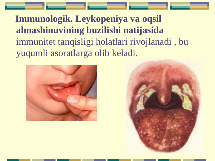    Immunologik. Leykopeniya va oqsil 
almashinuvining buzilishi natijasida 
immunitet tanqisligi holatlari rivojlanadi , bu 
yuqumli asoratlarga olib keladi.
