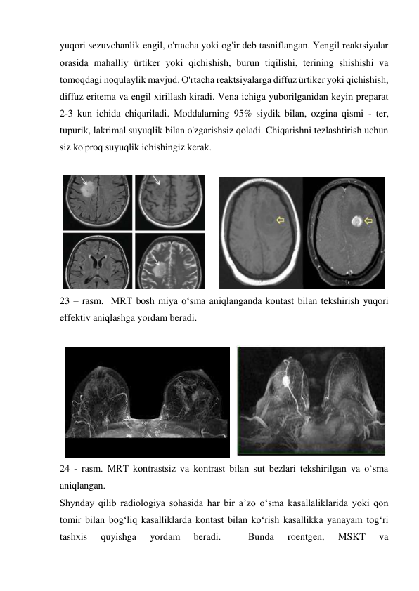 yuqori sezuvchanlik engil, o'rtacha yoki og'ir deb tasniflangan. Yengil reaktsiyalar 
orasida mahalliy ürtiker yoki qichishish, burun tiqilishi, terining shishishi va 
tomoqdagi noqulaylik mavjud. O'rtacha reaktsiyalarga diffuz ürtiker yoki qichishish, 
diffuz eritema va engil xirillash kiradi. Vena ichiga yuborilganidan keyin preparat 
2-3 kun ichida chiqariladi. Moddalarning 95% siydik bilan, ozgina qismi - ter, 
tupurik, lakrimal suyuqlik bilan o'zgarishsiz qoladi. Chiqarishni tezlashtirish uchun 
siz ko'proq suyuqlik ichishingiz kerak. 
 
      
 
23 – rasm.  MRT bosh miya o‘sma aniqlanganda kontast bilan tekshirish yuqori 
effektiv aniqlashga yordam beradi.  
 
  
   
 
24 - rasm. MRT kontrastsiz va kontrast bilan sut bezlari tekshirilgan va o‘sma 
aniqlangan.  
Shynday qilib radiologiya sohasida har bir a’zo o‘sma kasallaliklarida yoki qon 
tomir bilan bog‘liq kasalliklarda kontast bilan ko‘rish kasallikka yanayam tog‘ri 
tashxis 
quyishga 
yordam 
beradi. 
 
Bunda 
roentgen, 
MSKT 
va  

