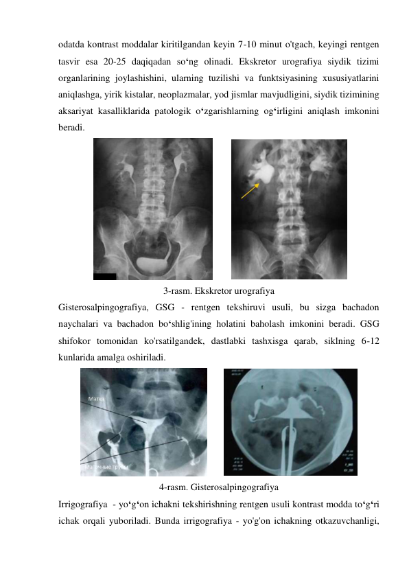 odatda kontrast moddalar kiritilgandan keyin 7-10 minut o'tgach, keyingi rentgen 
tasvir esa 20-25 daqiqadan so‘ng olinadi. Ekskretor urografiya siydik tizimi 
organlarining joylashishini, ularning tuzilishi va funktsiyasining xususiyatlarini 
aniqlashga, yirik kistalar, neoplazmalar, yod jismlar mavjudligini, siydik tizimining 
aksariyat kasalliklarida patologik o‘zgarishlarning og‘irligini aniqlash imkonini 
beradi. 
 
        
 
3-rasm. Ekskretor urografiya 
Gisterosalpingografiya, GSG - rentgen tekshiruvi usuli, bu sizga bachadon 
naychalari va bachadon bo‘shlig'ining holatini baholash imkonini beradi. GSG 
shifokor tomonidan ko'rsatilgandek, dastlabki tashxisga qarab, siklning 6-12 
kunlarida amalga oshiriladi. 
       
 
4-rasm. Gisterosalpingografiya 
Irrigografiya  - yo‘g‘on ichakni tekshirishning rentgen usuli kontrast modda to‘g‘ri 
ichak orqali yuboriladi. Bunda irrigografiya - yo'g'on ichakning otkazuvchanligi, 
