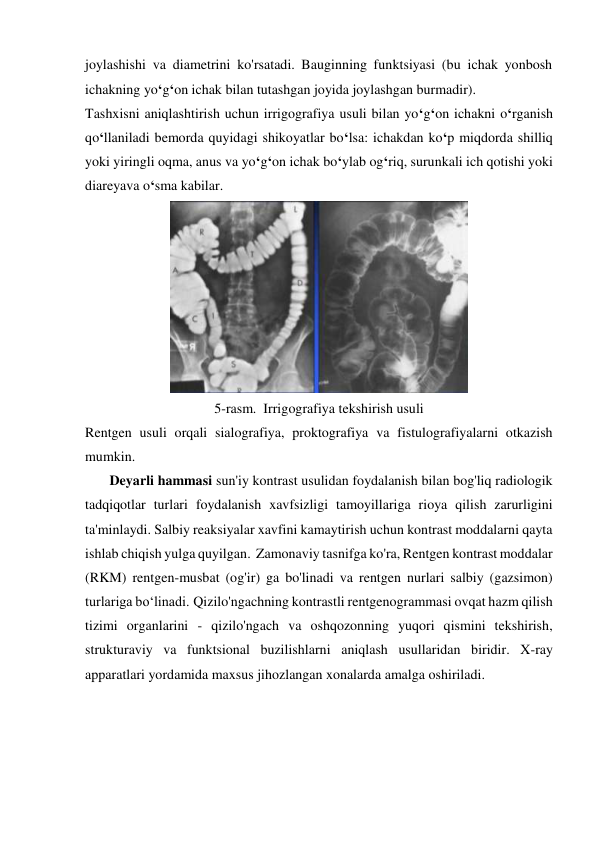 joylashishi va diametrini ko'rsatadi. Bauginning funktsiyasi (bu ichak yonbosh 
ichakning yo‘g‘on ichak bilan tutashgan joyida joylashgan burmadir). 
Tashxisni aniqlashtirish uchun irrigografiya usuli bilan yo‘g‘on ichakni o‘rganish 
qo‘llaniladi bemorda quyidagi shikoyatlar bo‘lsa: ichakdan ko‘p miqdorda shilliq 
yoki yiringli oqma, anus va yo‘g‘on ichak bo‘ylab og‘riq, surunkali ich qotishi yoki 
diareyava o‘sma kabilar.  
 
5-rasm.  Irrigografiya tekshirish usuli 
Rentgen usuli orqali sialografiya, proktografiya va fistulografiyalarni otkazish 
mumkin.  
       Deyarli hammasi sun'iy kontrast usulidan foydalanish bilan bog'liq radiologik 
tadqiqotlar turlari foydalanish xavfsizligi tamoyillariga rioya qilish zarurligini 
ta'minlaydi. Salbiy reaksiyalar xavfini kamaytirish uchun kontrast moddalarni qayta 
ishlab chiqish yulga quyilgan.  Zamonaviy tasnifga ko'ra, Rentgen kontrast moddalar 
(RKM) rentgen-musbat (og'ir) ga bo'linadi va rentgen nurlari salbiy (gazsimon) 
turlariga bo‘linadi. Qizilo'ngachning kontrastli rentgenogrammasi ovqat hazm qilish 
tizimi organlarini - qizilo'ngach va oshqozonning yuqori qismini tekshirish, 
strukturaviy va funktsional buzilishlarni aniqlash usullaridan biridir. X-ray 
apparatlari yordamida maxsus jihozlangan xonalarda amalga oshiriladi. 
   
