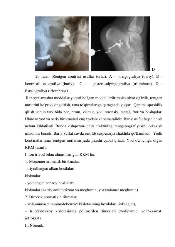   
  D 
20 rasm. Rentgen contrast usullar turlari. A -  irrigografiya (bariy). B -  
kontrastli ezografiya (bariy).  C -   gisterosalpingografiya (triombrast). D -  
fistulografiya (triombrast). 
 Rentgen-musbat moddalar yuqori bo'lgan moddalardir molekulyar og'irlik, rentgen 
nurlarini ko'proq singdirish, tana to'qimalariga qaraganda yuqori. Qarama-qarshilik 
qilish uchun tarkibida bor, brom, vismut, yod, stronsiy, tantal, ftor va boshqalar. 
Ulardan yod va bariy birikmalari eng xavfsiz va samaralidir. Bariy sulfat faqat ichish  
uchun ishlatiladi Bunda oshqozon-ichak traktining rentgenografiyasini otkazish 
imkonini beradi. Bariy sulfat suvda eritilib suspenziya shaklida qo'llaniladi.  Yodli 
kontarstlar xam rentgen nurlarini juda yaxshi qabul qiladi. Yod o'z ichiga olgan 
RKM tasnifi: 
I. Ion triyod bilan almashtirilgan RKM lar. 
1. Monomer aromatik birikmalar: 
- triyodlangan alkan hosilalari 
kislotalar; 
- yodlangan benzoy hosilalari 
kislotalar (natriy amidotrizoat va meglumin, yoxytalamat meglumin). 
2. Dimerik aromatik birikmalar: 
- arilaminoasetilaminodobenzoy kislotasining hosilalari (ioksaglat), 
– triiodobenzoy kislotasining polimetilen dimerlari (yodipamid, yodoksamat, 
iotroksat). 
II. Noionik. 
