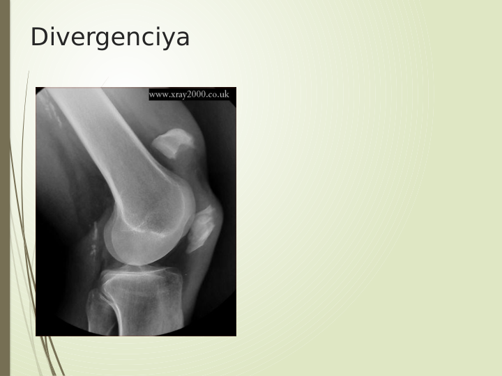 Divergenciya

