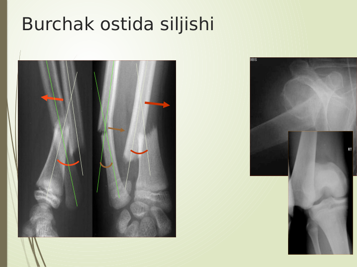 Burchak ostida siljishi
