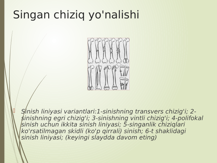 Singan chiziq yo'nalishi

Sinish liniyasi variantlari:1-sinishning transvers chizig'i; 2-
sinishning egri chizig'i; 3-sinishning vintli chizig'i; 4-polifokal 
sinish uchun ikkita sinish liniyasi; 5-singanlik chiziqlari 
ko'rsatilmagan skidli (ko'p qirrali) sinish; 6-t shaklidagi 
sinish liniyasi; (keyingi slaydda davom eting)
