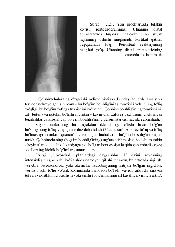  
Surat . 2.21. Yon proektsiyada bilakni 
ko'rish 
rentgenogrammasi. 
Ulnaning 
distal 
epimetafizida hujayrali halokat bilan suyak 
hajmining oshishi aniqlanadi, kortikal qatlam 
yupqalanadi 
(o'q). 
Periosteal 
reaktsiyaning 
belgilari yo'q. Ulnaning distal epimetafizining 
osteoblastoklastomasi. 
     
   Qo'shimchalarning o'zgarishi radiosemiotikasi.Bunday hollarda asosiy va 
tez -tez uchraydigan simptom - bu bo'g'im bo'shlig'ining torayishi yoki uning to'liq 
yo'qligi, bu bo'g'im xaftaga tushishini ko'rsatadi. Qo'shish bo'shlig'ining torayishi bir 
xil (butun) va notekis bo'lishi mumkin - keyin ular xaftaga yaxlitligini cheklangan 
buzilishlariga asoslangan bo'g'im bo'shlig'ining deformatsiyasi haqida gapirishadi. 
Suyak nurlarining bir suyakdan ikkinchisiga o'tishi bilan bo'g'im 
bo'shlig'ining to'liq yo'qligi ankiloz deb ataladi (2.22 -rasm). Ankiloz to'liq va to'liq 
bo'lmasligi mumkin (qisman) - cheklangan hududlarda bo'g'im bo'shlig'ini saqlab 
turish. Qo'shimchaning (bo'g'im bo'shlig'ining) tug'ma etishmasligi bo'lishi mumkin 
- keyin ular odatda lokalizatsiyaga ega bo'lgan kontsessiya haqida gapirishadi - oyoq 
-qo'llarning kichik bo'g'imlari, umurtqalar. 
Oxirgi 
(subkondral) 
plitalardagi 
o'zgarishlar. 
U 
o'zini 
soyasining 
intensivligining oshishi ko'rinishida namoyon qilishi mumkin, bu artrozda siqilish, 
vertebra osteoxondrozi yoki aksincha, rezorbsiyaning natijasi bo'lgan ingichka, 
yorilish yoki to'liq yo'qlik ko'rinishida namoyon bo'ladi. vayron qiluvchi jarayon 
tufayli yaxlitlikning buzilishi yoki erishi (bo'g'imlarning sil kasalligi, yiringli artrit). 
