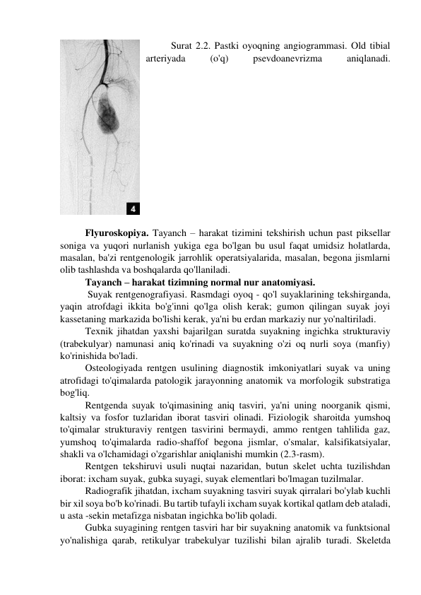 Surat 2.2. Pastki oyoqning angiogrammasi. Old tibial 
arteriyada 
(o'q) 
psevdoanevrizma 
aniqlanadi. 
 
Flyuroskopiya. Tayanch – harakat tizimini tekshirish uchun past piksellar 
soniga va yuqori nurlanish yukiga ega bo'lgan bu usul faqat umidsiz holatlarda, 
masalan, ba'zi rentgenologik jarrohlik operatsiyalarida, masalan, begona jismlarni 
olib tashlashda va boshqalarda qo'llaniladi. 
Tayanch – harakat tizimning normal nur anatomiyasi. 
 Suyak rentgenografiyasi. Rasmdagi oyoq - qo'l suyaklarining tekshirganda, 
yaqin atrofdagi ikkita bo'g'inni qo'lga olish kerak; gumon qilingan suyak joyi 
kassetaning markazida bo'lishi kerak, ya'ni bu erdan markaziy nur yo'naltiriladi.  
Texnik jihatdan yaxshi bajarilgan suratda suyakning ingichka strukturaviy 
(trabekulyar) namunasi aniq ko'rinadi va suyakning o'zi oq nurli soya (manfiy) 
ko'rinishida bo'ladi. 
Osteologiyada rentgen usulining diagnostik imkoniyatlari suyak va uning 
atrofidagi to'qimalarda patologik jarayonning anatomik va morfologik substratiga 
bog'liq. 
Rentgenda suyak to'qimasining aniq tasviri, ya'ni uning noorganik qismi, 
kaltsiy va fosfor tuzlaridan iborat tasviri olinadi. Fiziologik sharoitda yumshoq 
to'qimalar strukturaviy rentgen tasvirini bermaydi, ammo rentgen tahlilida gaz, 
yumshoq to'qimalarda radio-shaffof begona jismlar, o'smalar, kalsifikatsiyalar, 
shakli va o'lchamidagi o'zgarishlar aniqlanishi mumkin (2.3-rasm). 
Rentgen tekshiruvi usuli nuqtai nazaridan, butun skelet uchta tuzilishdan 
iborat: ixcham suyak, gubka suyagi, suyak elementlari bo'lmagan tuzilmalar. 
Radiografik jihatdan, ixcham suyakning tasviri suyak qirralari bo'ylab kuchli 
bir xil soya bo'b ko'rinadi. Bu tartib tufayli ixcham suyak kortikal qatlam deb ataladi, 
u asta -sekin metafizga nisbatan ingichka bo'lib qoladi. 
Gubka suyagining rentgen tasviri har bir suyakning anatomik va funktsional 
yo'nalishiga qarab, retikulyar trabekulyar tuzilishi bilan ajralib turadi. Skeletda 
