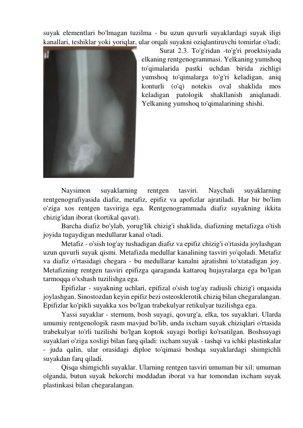 suyak elementlari bo'lmagan tuzilma - bu uzun quvurli suyaklardagi suyak iligi 
kanallari, teshiklar yoki yoriqlar, ular orqali suyakni oziqlantiruvchi tomirlar o'tadi;  
Surat 2.3. To'g'ridan -to'g'ri proektsiyada 
elkaning rentgenogrammasi. Yelkaning yumshoq 
to'qimalarida pastki uchdan birida zichligi 
yumshoq to'qimalarga to'g'ri keladigan, aniq 
konturli (o'q) notekis oval shaklida mos 
keladigan patologik shakllanish aniqlanadi. 
Yelkaning yumshoq to'qimalarining shishi. 
 
 
Naysimon 
suyaklarning 
rentgen 
tasviri. 
Naychali 
suyaklarning 
rentgenografiyasida diafiz, metafiz, epifiz va apofizlar ajratiladi. Har bir bo'lim 
o'ziga xos rentgen tasviriga ega. Rentgenogrammada diafiz suyakning ikkita 
chizig'idan iborat (kortikal qavat). 
Barcha diafiz bo'ylab, yorug'lik chizig'i shaklida, diafizning metafizga o'tish 
joyida tugaydigan medullarar kanal o'tadi. 
Metafiz - o'sish tog'ay tushadigan diafiz va epifiz chizig'i o'rtasida joylashgan 
uzun quvurli suyak qismi. Metafizda medullar kanalining tasviri yo'qoladi. Metafiz 
va diafiz o'rtasidagi chegara - bu medullarar kanalni ajratishni to'xtatadigan joy. 
Metafizning rentgen tasviri epifizga qaraganda kattaroq hujayralarga ega bo'lgan 
tarmoqqa o'xshash tuzilishga ega. 
Epifizlar - suyakning uchlari, epifizal o'sish tog'ay radiusli chizig'i orqasida 
joylashgan. Sinostozdan keyin epifiz bezi osteosklerotik chiziq bilan chegaralangan. 
Epifizlar ko'pikli suyakka xos bo'lgan trabekulyar retikulyar tuzilishga ega.  
Yassi suyaklar - sternum, bosh suyagi, qovurg'a, elka, tos suyaklari. Ularda 
umumiy rentgenologik rasm mavjud bo'lib, unda ixcham suyak chiziqlari o'rtasida 
trabekulyar to'rli tuzilishi bo'lgan koptok suyagi borligi ko'rsatilgan. Boshsuyagi 
suyaklari o'ziga xosligi bilan farq qiladi: ixcham suyak - tashqi va ichki plastinkalar 
- juda qalin, ular orasidagi diploe to'qimasi boshqa suyaklardagi shimgichli 
suyakdan farq qiladi. 
Qisqa shimgichli suyaklar. Ularning rentgen tasviri umuman bir xil: umuman 
olganda, butun suyak bekorchi moddadan iborat va har tomondan ixcham suyak 
plastinkasi bilan chegaralangan. 
