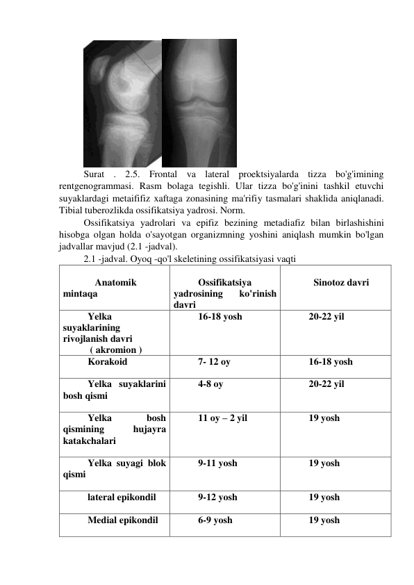  
Surat . 2.5. Frontal va lateral proektsiyalarda tizza bo'g'imining 
rentgenogrammasi. Rasm bolaga tegishli. Ular tizza bo'g'inini tashkil etuvchi 
suyaklardagi metaififiz xaftaga zonasining ma'rifiy tasmalari shaklida aniqlanadi. 
Tibial tuberozlikda ossifikatsiya yadrosi. Norm. 
Ossifikatsiya yadrolari va epifiz bezining metadiafiz bilan birlashishini 
hisobga olgan holda o'sayotgan organizmning yoshini aniqlash mumkin bo'lgan 
jadvallar mavjud (2.1 -jadval). 
2.1 -jadval. Oyoq -qo'l skeletining ossifikatsiyasi vaqti 
 
   Anatomik 
mintaqa  
 
Ossifikatsiya  
yadrosining 
ko'rinish 
davri  
    
  Sinotoz davri  
Yelka 
suyaklarining 
rivojlanish davri 
 ( akromion ) 
16-18 yosh  
20-22 yil  
Korakoid  
 
7- 12 oy  
16-18 yosh 
Yelka suyaklarini 
bosh qismi  
 
4-8 oy  
20-22 yil 
Yelka 
bosh 
qismining 
hujayra 
katakchalari 
  
11 oy – 2 yil 
19 yosh 
Yelka suyagi blok 
qismi 
 
9-11 yosh  
19 yosh  
lateral epikondil 
 
9-12 yosh  
19 yosh  
Medial epikondil 
 
6-9 yosh  
19 yosh  
