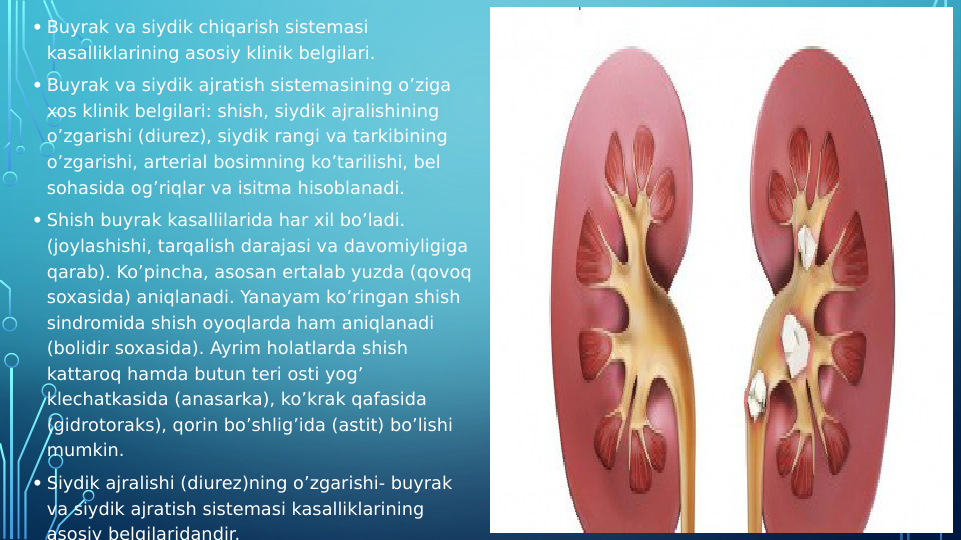  
• Buyrak va siydik chiqarish sistemasi 
kasalliklarining asosiy klinik belgilari.
• Buyrak va siydik ajratish sistemasining o’ziga 
xos klinik belgilari: shish, siydik ajralishining 
o’zgarishi (diurez), siydik rangi va tarkibining 
o’zgarishi, arterial bosimning ko’tarilishi, bel 
sohasida og’riqlar va isitma hisoblanadi.
• Shish buyrak kasallilarida har xil bo’ladi. 
(joylashishi, tarqalish darajasi va davomiyligiga 
qarab). Ko’pincha, asosan ertalab yuzda (qovoq 
soxasida) aniqlanadi. Yanayam ko’ringan shish 
sindromida shish oyoqlarda ham aniqlanadi 
(bolidir soxasida). Ayrim holatlarda shish 
kattaroq hamda butun teri osti yog’ 
klechatkasida (anasarka), ko’krak qafasida 
(gidrotoraks), qorin bo’shlig’ida (astit) bo’lishi 
mumkin.
• Siydik ajralishi (diurez)ning o’zgarishi- buyrak 
va siydik ajratish sistemasi kasalliklarining 
asosiy belgilaridandir.
